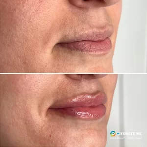 BeforeAfterExample copy