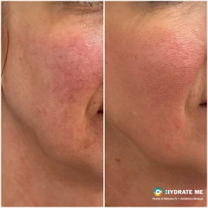 Copy of Before & After Template.png