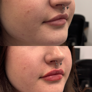 B&A Template - review
