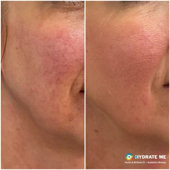 Copy of Before & After Template.png