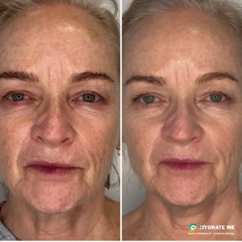 Copy of Before (Instagram Post).png